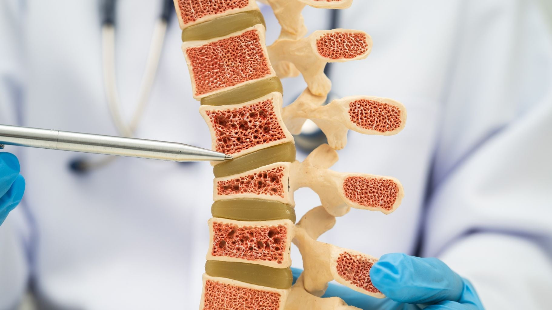 WORLD OSTEOPOROSIS DAY 2015