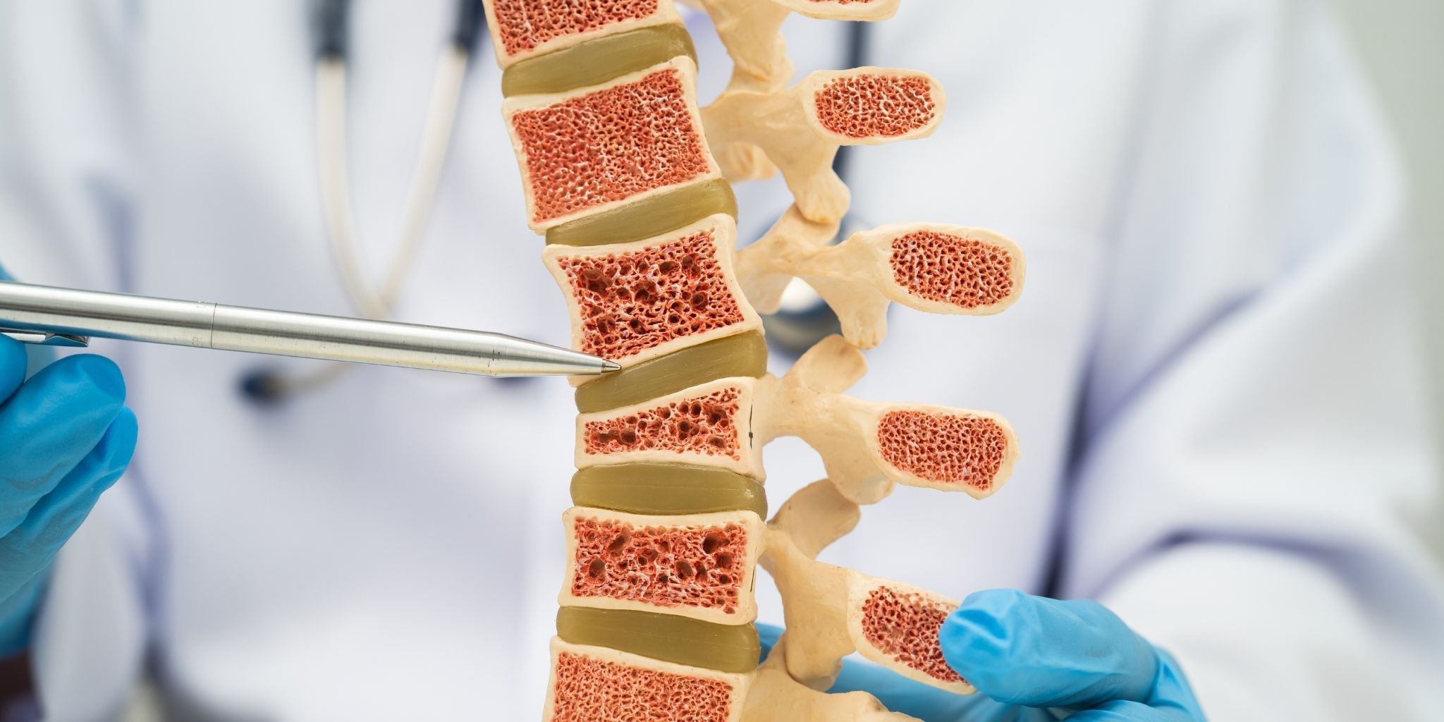 WORLD OSTEOPOROSIS DAY 2015